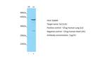 SLC11A1 Antibody in Western Blot (WB)