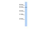 SLC27A6 Antibody in Western Blot (WB)