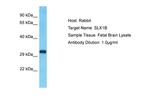 SLX1B Antibody in Western Blot (WB)