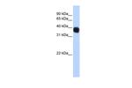 SSBP3 Antibody in Western Blot (WB)