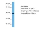 ST3GAL4 Antibody in Western Blot (WB)