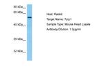 TYRP1 Antibody in Western Blot (WB)