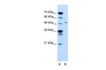 TYRP1 Antibody in Western Blot (WB)