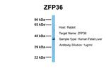 ZFP36 Antibody in Western Blot (WB)