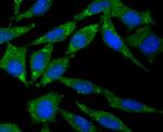 CD21 Antibody in Immunocytochemistry (ICC/IF)