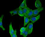 CD21 Antibody in Immunocytochemistry (ICC/IF)