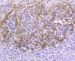 CD21 Antibody in Immunohistochemistry (Paraffin) (IHC (P))