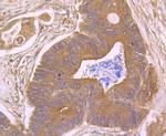 CD21 Antibody in Immunohistochemistry (Paraffin) (IHC (P))