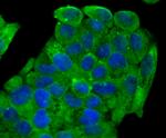 SCN9A Antibody in Immunocytochemistry (ICC/IF)