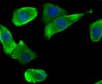 SCN9A Antibody in Immunocytochemistry (ICC/IF)