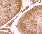 SCN9A Antibody in Immunohistochemistry (Paraffin) (IHC (P))