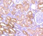 AMACR Antibody in Immunohistochemistry (Paraffin) (IHC (P))