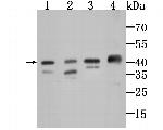 AMACR Antibody in Western Blot (WB)