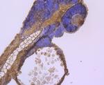 CD127 Antibody in Immunohistochemistry (Paraffin) (IHC (P))