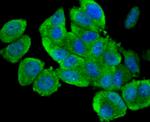 ULK1 Antibody in Immunocytochemistry (ICC/IF)