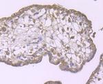 ULK1 Antibody in Immunohistochemistry (Paraffin) (IHC (P))