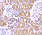 ULK1 Antibody in Immunohistochemistry (Paraffin) (IHC (P))