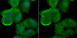 ATG7 Antibody in Immunocytochemistry (ICC/IF)