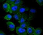 LC3A/LC3B Antibody in Immunocytochemistry (ICC/IF)