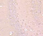 LC3A/LC3B Antibody in Immunohistochemistry (Paraffin) (IHC (P))