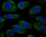 Noggin Antibody in Immunocytochemistry (ICC/IF)