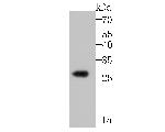 Noggin Antibody in Western Blot (WB)