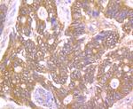 PTP1B Antibody in Immunohistochemistry (Paraffin) (IHC (P))