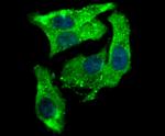 Aromatase Antibody in Immunocytochemistry (ICC/IF)