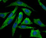 Aromatase Antibody in Immunocytochemistry (ICC/IF)