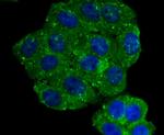 Aromatase Antibody in Immunocytochemistry (ICC/IF)