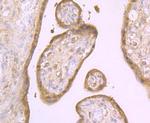 Aromatase Antibody in Immunohistochemistry (Paraffin) (IHC (P))