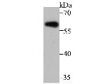 Aromatase Antibody in Western Blot (WB)