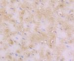 RAB7A Antibody in Immunohistochemistry (Paraffin) (IHC (P))