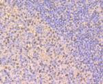 RAB7A Antibody in Immunohistochemistry (Paraffin) (IHC (P))