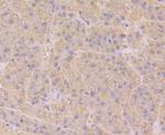 RAB7A Antibody in Immunohistochemistry (Paraffin) (IHC (P))