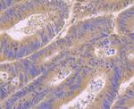 RAB7A Antibody in Immunohistochemistry (Paraffin) (IHC (P))