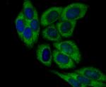 DIAPH3 Antibody in Immunocytochemistry (ICC/IF)