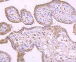 DIAPH3 Antibody in Immunohistochemistry (Paraffin) (IHC (P))