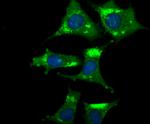 NGF Antibody in Immunocytochemistry (ICC/IF)