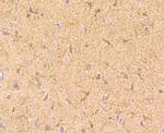 NGF Antibody in Immunohistochemistry (Paraffin) (IHC (P))