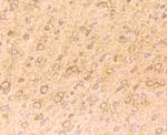 NGF Antibody in Immunohistochemistry (Paraffin) (IHC (P))