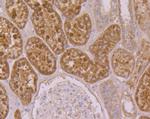 SUFU Antibody in Immunohistochemistry (Paraffin) (IHC (P))