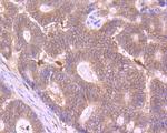 SUFU Antibody in Immunohistochemistry (Paraffin) (IHC (P))