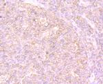 PTP1B Antibody in Immunohistochemistry (Paraffin) (IHC (P))