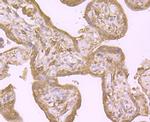 PTP1B Antibody in Immunohistochemistry (Paraffin) (IHC (P))