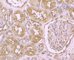 PTP1B Antibody in Immunohistochemistry (Paraffin) (IHC (P))