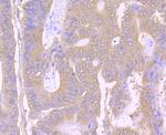 PTP1B Antibody in Immunohistochemistry (Paraffin) (IHC (P))