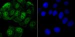 ROC1 Antibody in Immunocytochemistry (ICC/IF)