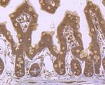 ROC1 Antibody in Immunohistochemistry (Paraffin) (IHC (P))