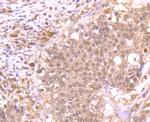 ROC1 Antibody in Immunohistochemistry (Paraffin) (IHC (P))